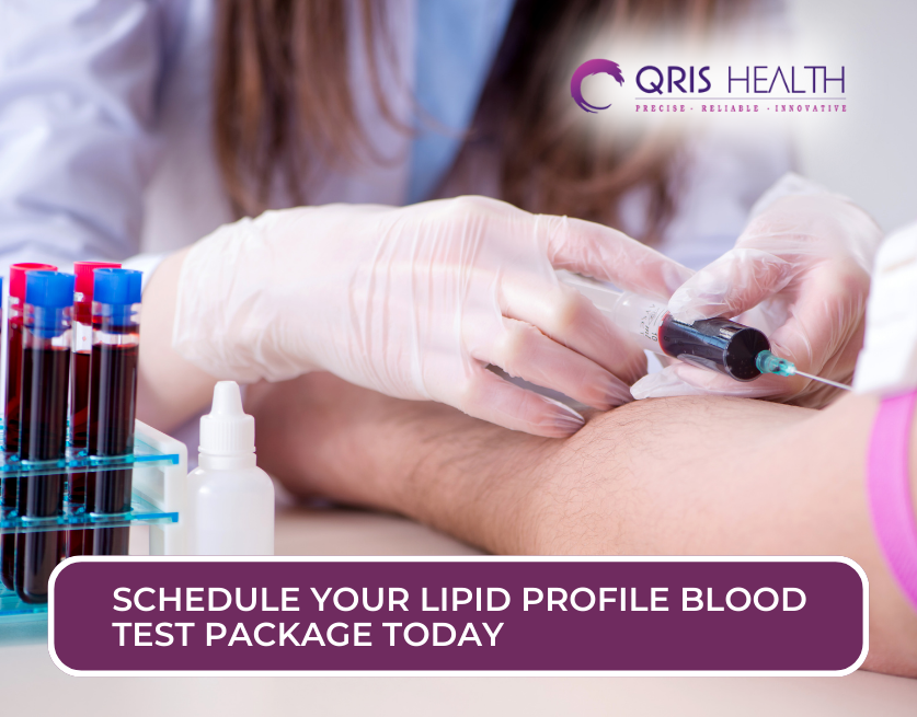Lipid Profile Blood Test